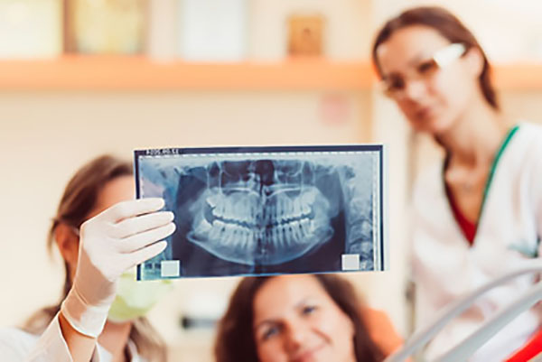 5 Factors That Determine How Often You Need Dental X-Rays