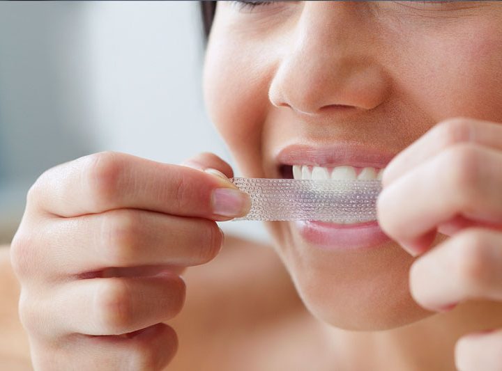 Is Whitening the Teeth Safe?